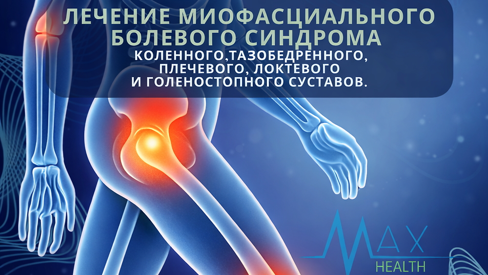 Модуль 2. Суставы. Лечение миофасциального болевого синдрома коленного, тазобедренного, плечевого, локтевого и голеностопного суставов