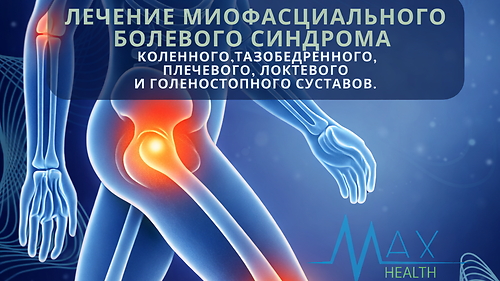 Модуль 2. Суставы. Лечение миофасциального болевого синдрома коленного, тазобедренного, плечевого, локтевого и голеностопного суставов