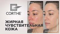 Вебинар