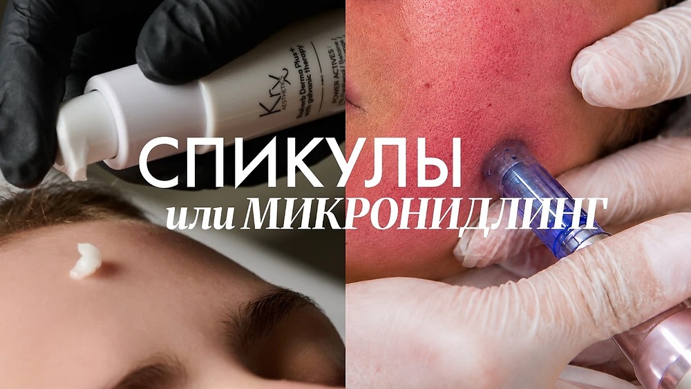 ОБУЧАЮЩЕЕ ВИДЕО 'Спикулы или микронидлинг — что выбрать?'