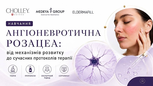 Ангіоневротична розацеа: від механізмів розвитку до сучасних протоколів терапії