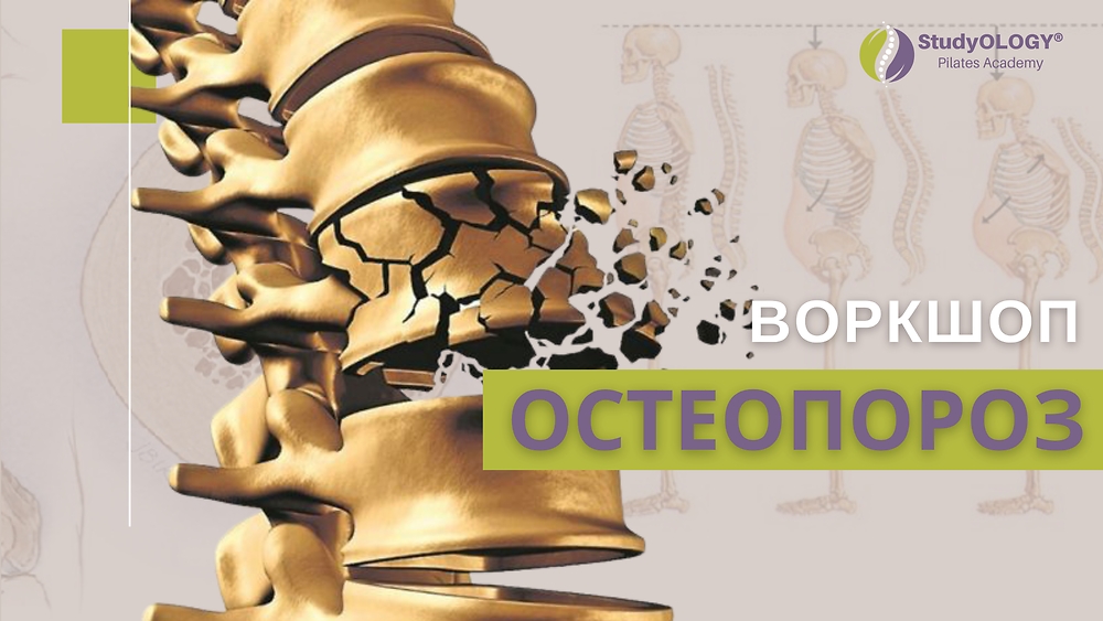 Воркшоп 'ОСТЕОПОРОЗ' | UA