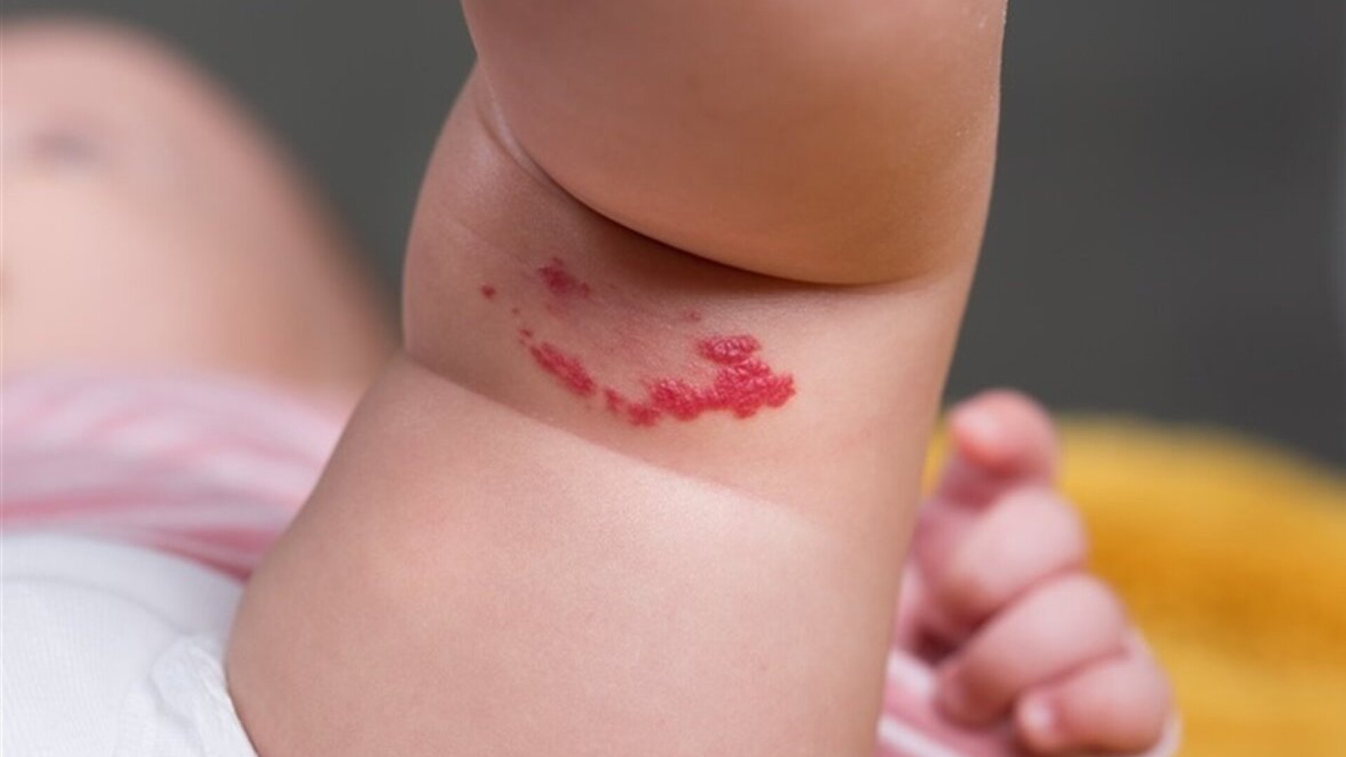 «Утворення шкіри у дітей» В. Ганжа