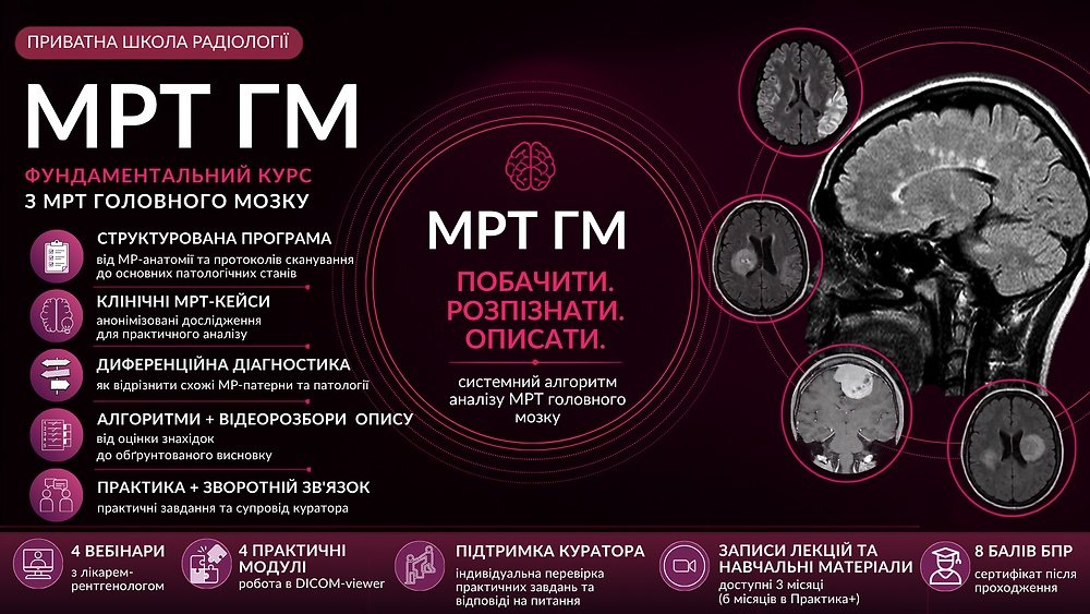 МРТ Головного мозку