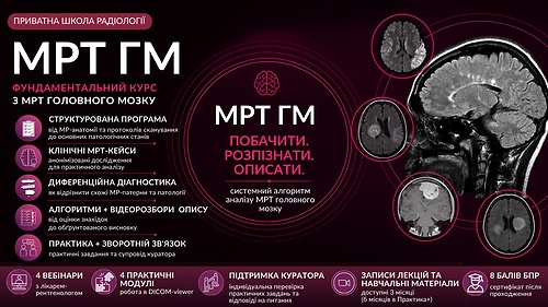 МРТ Головного мозку