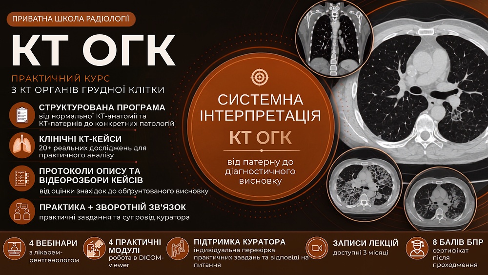КТ органів грудної клітки
