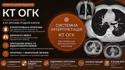 КТ органів грудної клітки