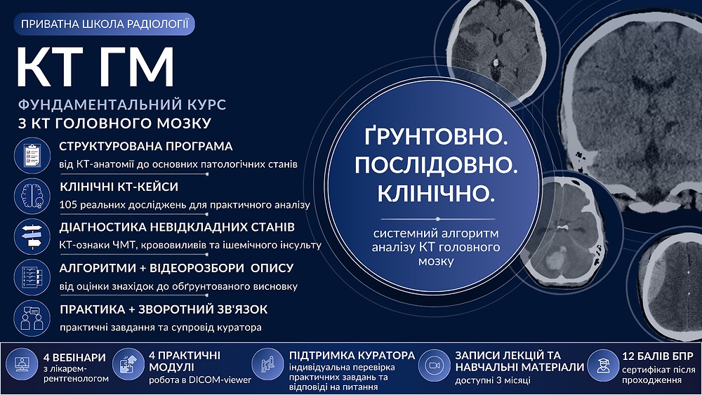 КТ Головного мозку