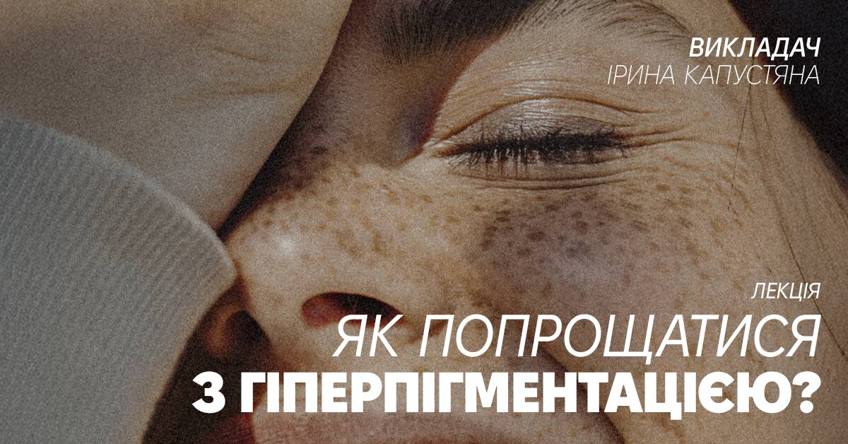 Як попрощатися з гіперпігментацією?