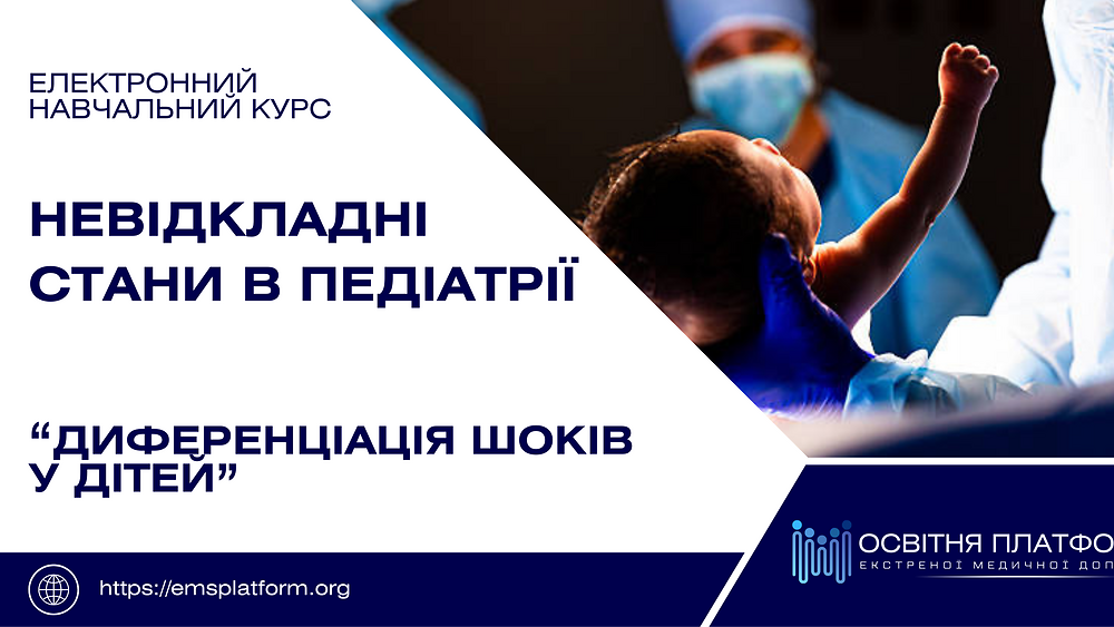 Електронний курс 'Диференціація шоків'