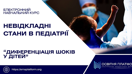 Електронний курс 'Диференціація шоків'