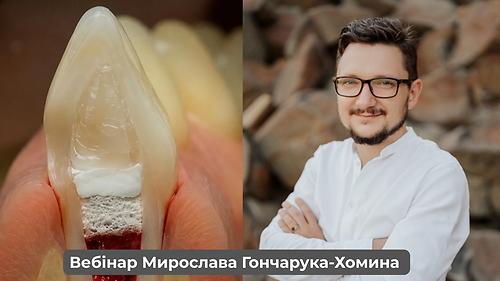 Вебінар «Регенераторна ендодонтія: як зберегти зуб із некрозом пульпи та несформованим коренем» (Мирослав Гончарук-Хомин)
