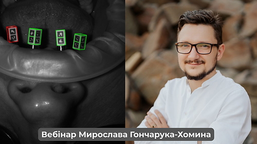 Вебінар «Байт-реєстрація на зубах та імплантах» (Мирослав Гончарук-Хомин)