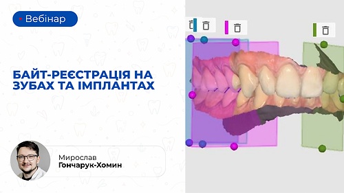Вебінар «Байт-реєстрація на зубах та імплантах» (Мирослав Гончарук-Хомин)