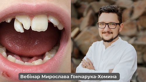 Вебінар «Дентальні травми: алгоритм дій від діагностики до вибору тактики» (Мирослав Гончарук-Хомин)