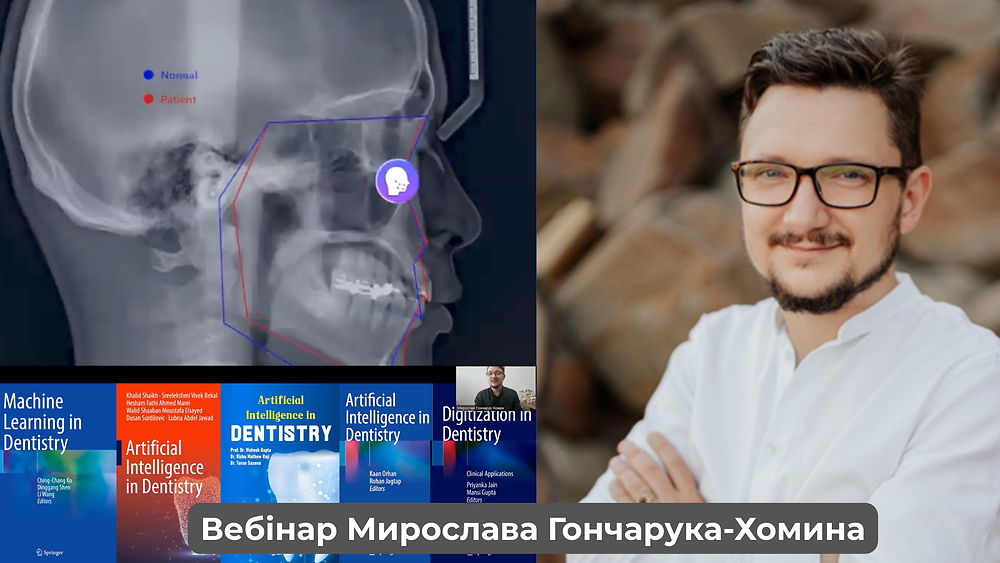 Вебінар 'Штучний інтелект в стоматології' (Мирослав Гончарук-Хомин)