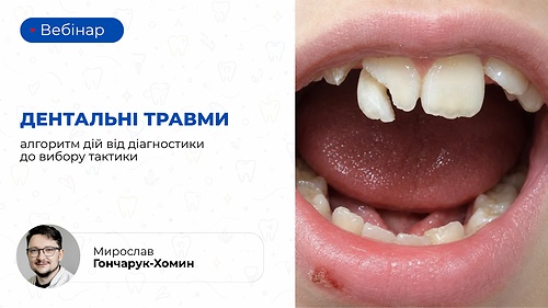 Вебінар «Дентальні травми: алгоритм дій від діагностики до вибору тактики» (Мирослав Гончарук-Хомин)