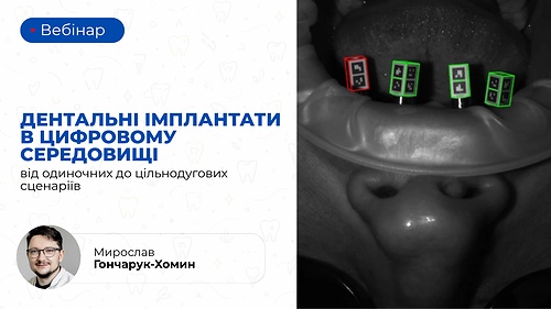Вебінар «Дентальні імплантати в цифровому середовищі: від одиночних до цільнодугових сценаріїв» (Мирослав Гончарук-Хомин)