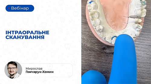 Вебінар 'Інтраоральне сканування' (Мирослав Гончарук-Хомин)