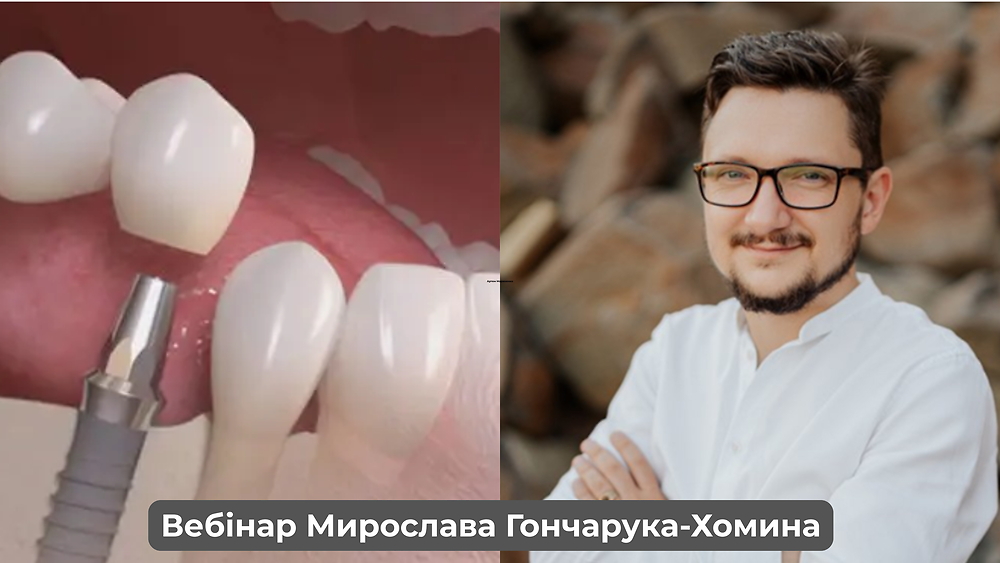 Вебінар «Дентальні імплантати в цифровому середовищі: від одиночних до цільнодугових сценаріїв» (Мирослав Гончарук-Хомин)