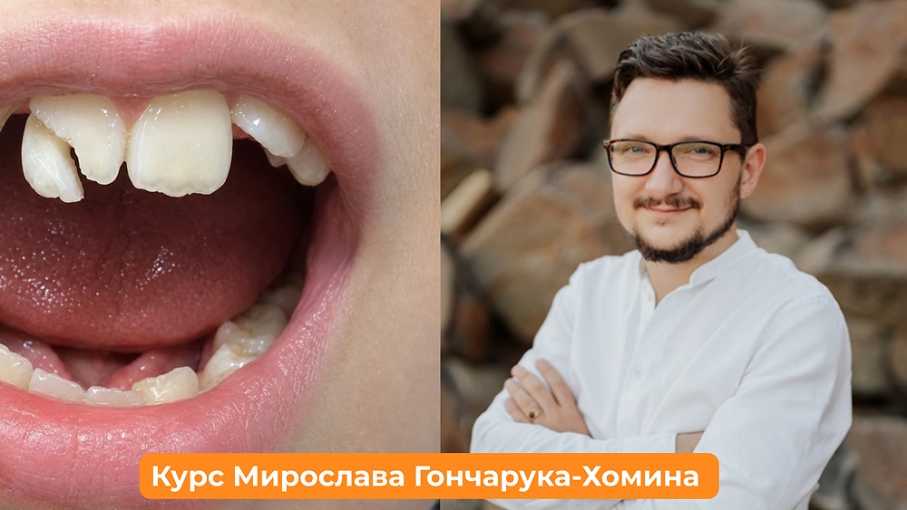 Вебінар «Сходинки, облітерації, кривизна: принципи інструментальної обробки каналів» (Мирослав Гончарук-Хомин)