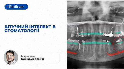 Вебінар 'Штучний інтелект в стоматології' (Мирослав Гончарук-Хомин)