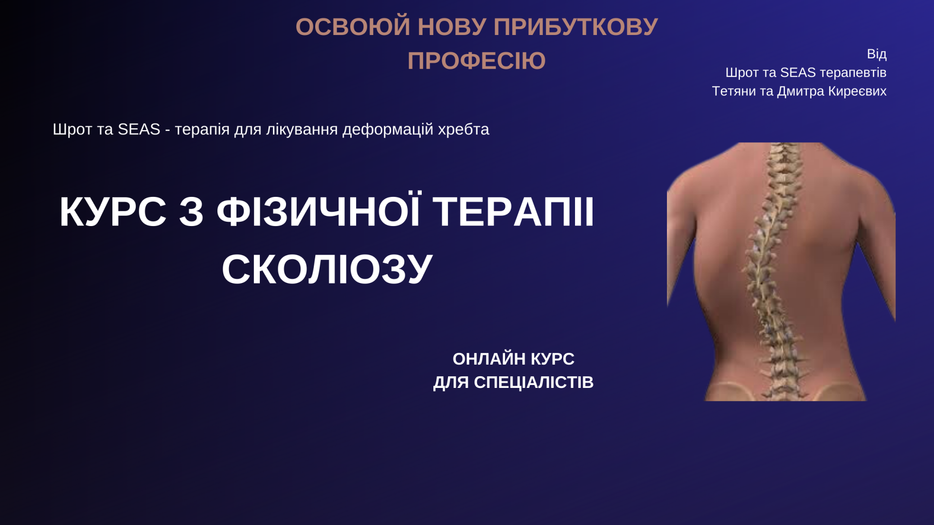 Сколіоз пацієнт 4