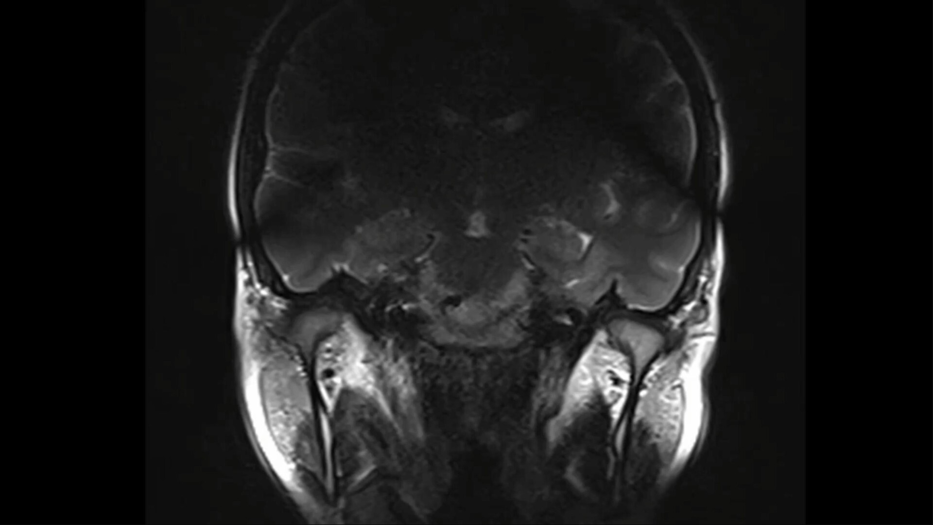 «Буденний МРТ-аналіз СНЩС» Т. Глущенко