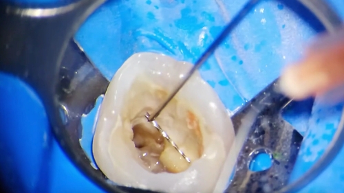 «Вилучення зламаних інструментів» А. Калагурко