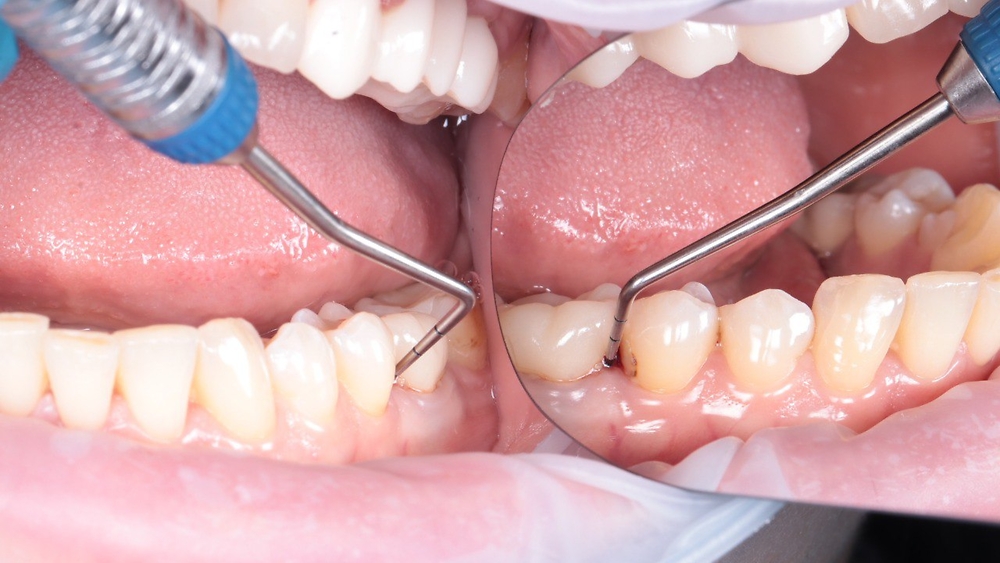 «ТОП-10 рішень в періолікуванні» Ю. Новікова