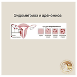 Бонусный урок- эндометриоз, лактация